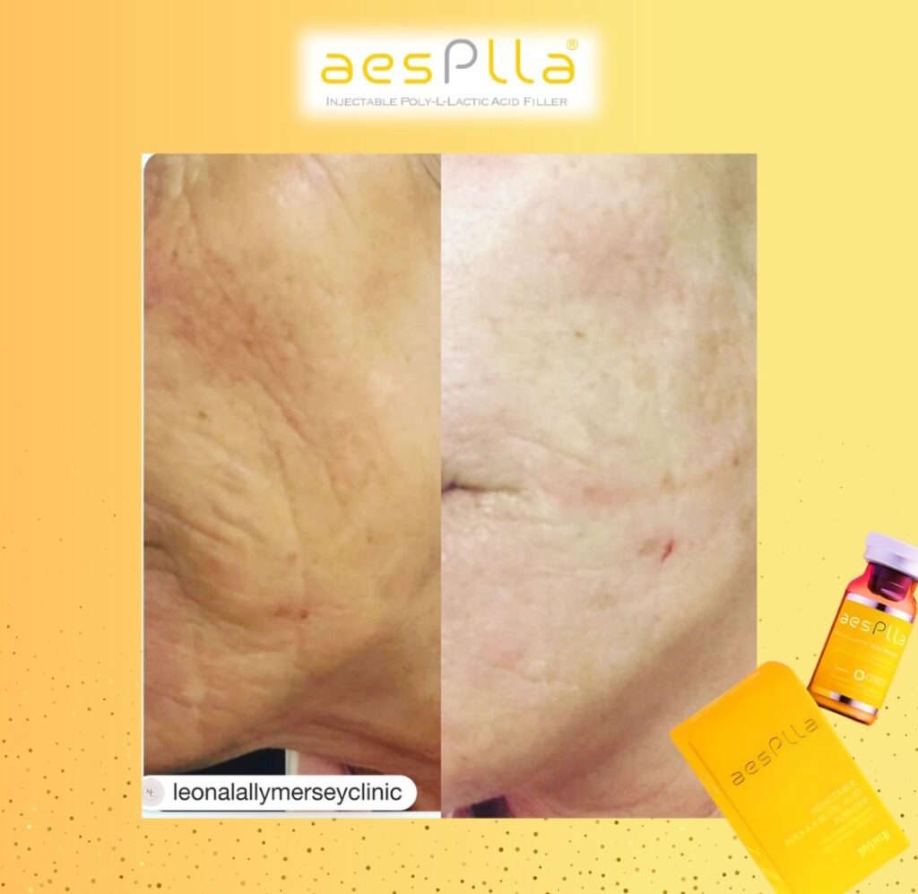 Manfaat Kolagen Untuk Kekenyalan Kulit Panduan Lengkap Menjaga Elasitas Dan Kesehatan Dermal